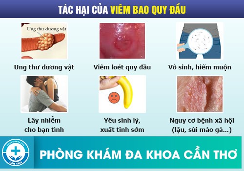 Những biến chứng nguy hiểm do viêm bao quy đầu gây ra