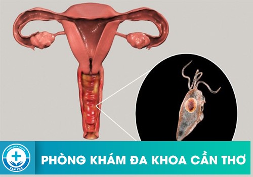 Vùng Kín Ra Nhiều Dịch Màu Vàng Có Mùi Hôi Khó Chịu