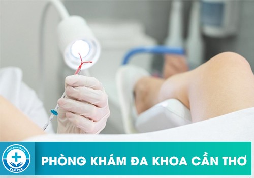 Thời điểm đặt vòng tránh thai