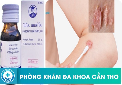 Hướng dẫn sử dụng thuốc Podophyllin 25 đúng cách