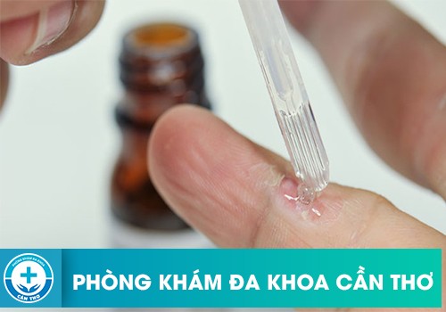 Biến chứng khi dùng thuốc podophyllin không đúng cách