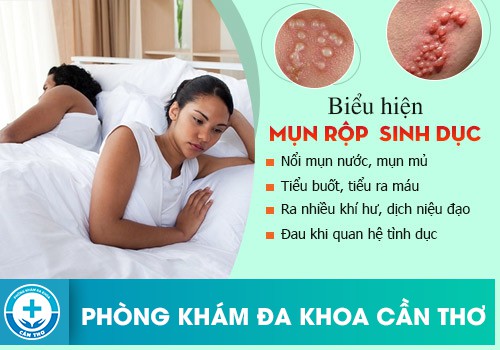 Triệu chứng mụn rộp sinh dục