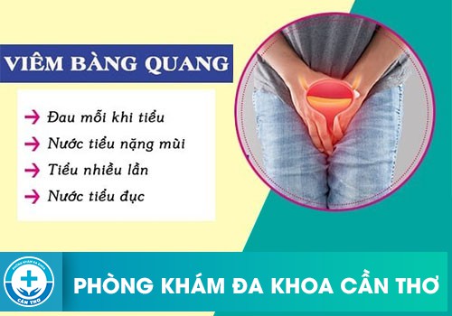 viêm bàng quang