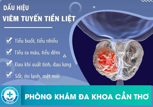 Tiểu nhiều, tiểu buốt là một trong những biểu hiện của bệnh viêm tuyến tiền liệt