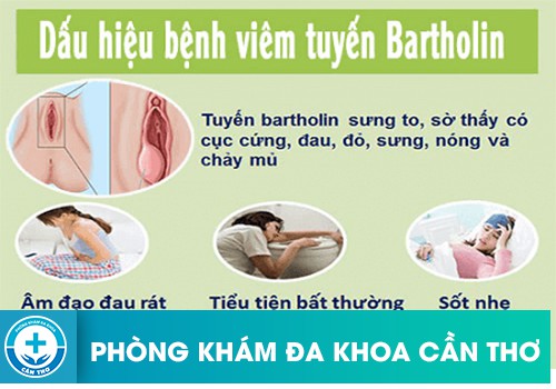 Dấu hiệu nhận biết viêm tuyến bartholin