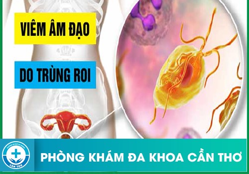 Ngứa vùng kín và ra dịch trắng