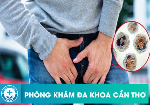 Những đối tượng có nguy cơ cao mắc viêm bao quy đầu