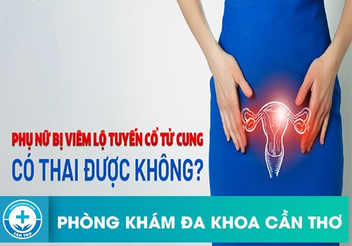 Viêm Lộ Tuyến Cổ Tử Cung Có Thể Mang Thai Được Không?