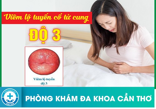 viem lo tuyen co tu cung do 3 co nguy hiem khong