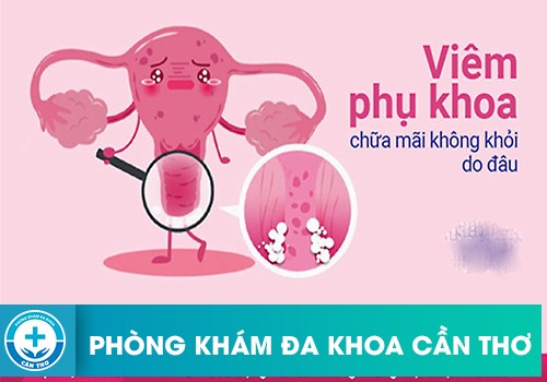 Vì sao điều trị viêm phụ khoa mãi không hết