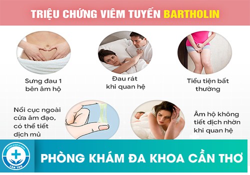 viêm tuyến bartholin là gì