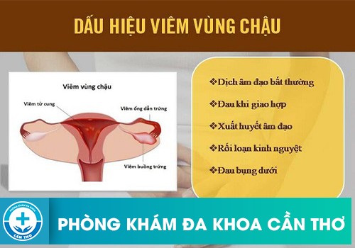 Triệu Chứng Viêm Vùng Chậu Thường Gặp Ở Nữ Giới