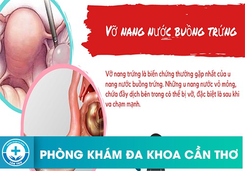 Vỡ nang buồng trứng có nguy hiểm không?