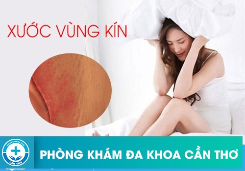 viêm âm đạo có thể do cơ thể thường xuyên bị mệt mỏi