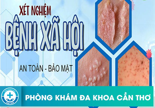 phòng khám xét nghiệm bệnh xã hội uy tín ở Cần Thơ