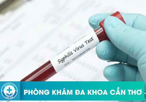 ⚕️ Xét Nghiệm Syphilis Là Gì? Cần Lưu Ý Gì Đối Với Xét Nghiệm Syphilis?