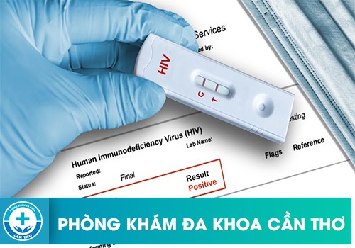 Xét Nghiệm HIV 3 Phương Pháp Là Gì