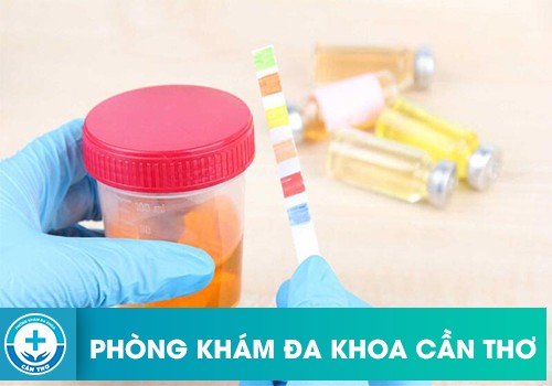 Xét Nghiệm Nước Tiểu Có Phát Hiện Bệnh Lậu Không?