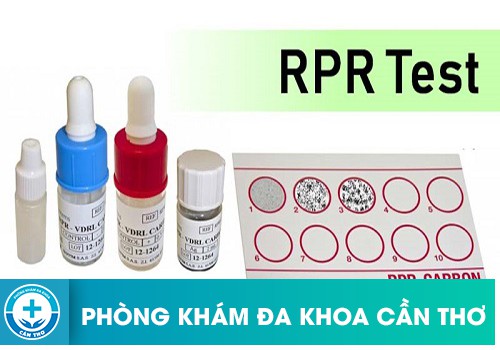 ⚕️ Xét Nghiệm RPR Và TPHA Là Gì?