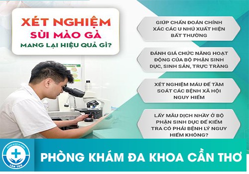 Chẩn đoán sùi mào gà bằng cách thực hiện xét nghiệm sùi mào gà