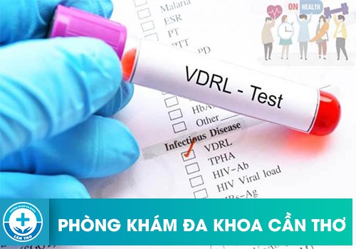 ⚕️ Xét Nghiệm VDRL Và TPHA Là Gì?