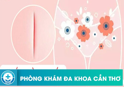 Xước vùng kín có nguy hiểm không? 